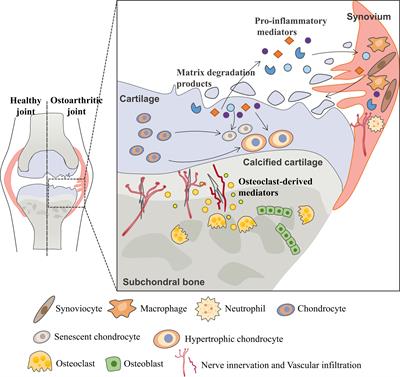 G Protein-Coupled Receptors in Osteoarthritis